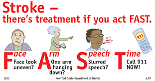 Stroke or Cerebroventricular Accident (CVA) Stroke or Cerebroventricular Accident (CVA)
